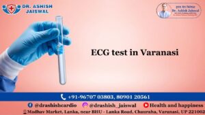 ECG test in Varanasi